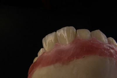 how to prevent gingivitis