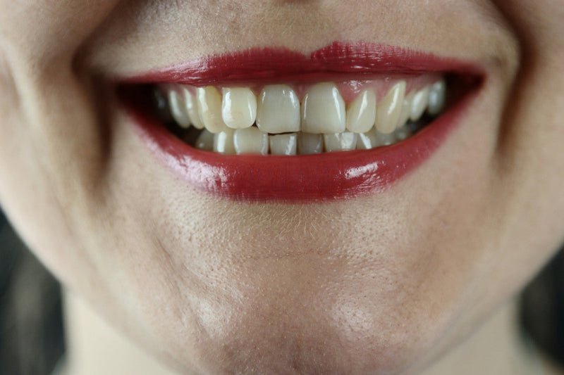 Tom’s vs Hello Toothpaste: How Do They Compare to LIVFRESH?