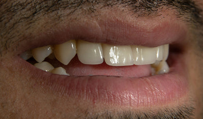 baking soda vs toothpaste