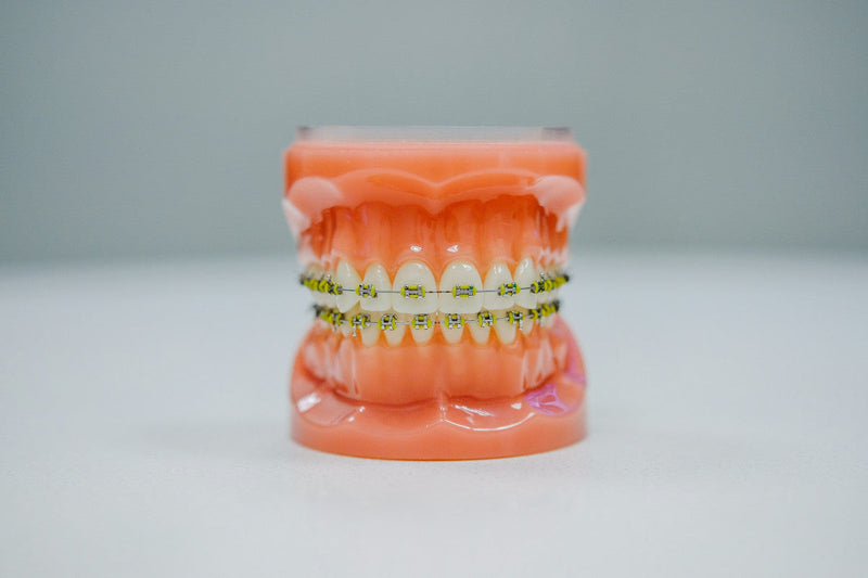 What is the Best Mouthwash For Bleeding Gums?