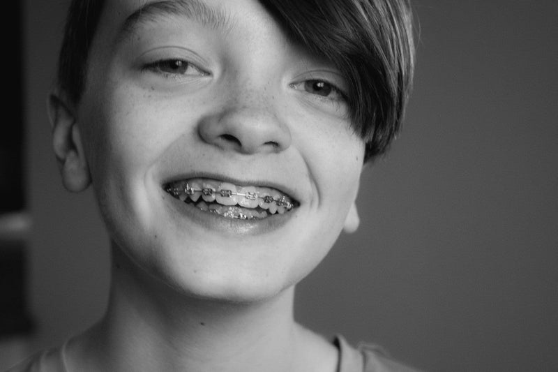 Ranking the Best Toothpaste For Braces