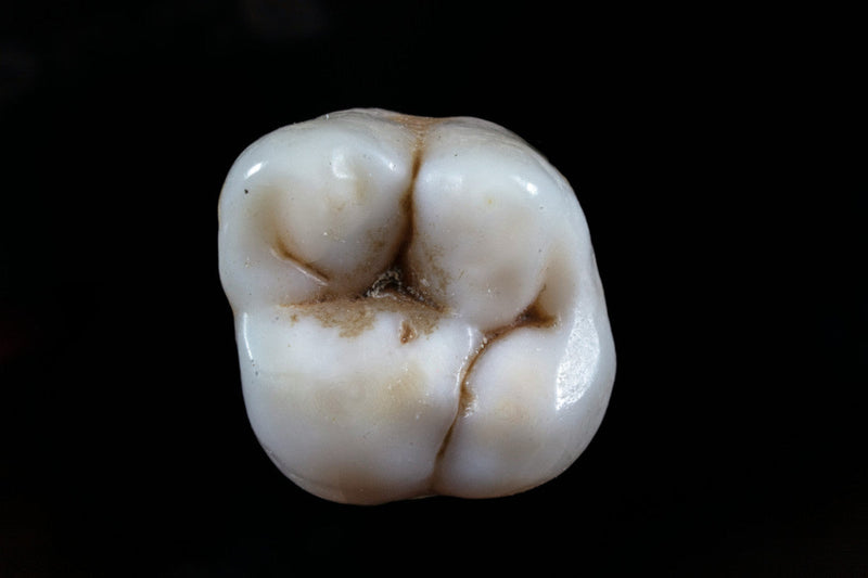 What is the Best Toothpaste For Cavities?