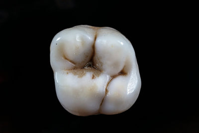 What is the Best Toothpaste For Cavities?