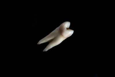 can remineralizing toothpaste heal cavities