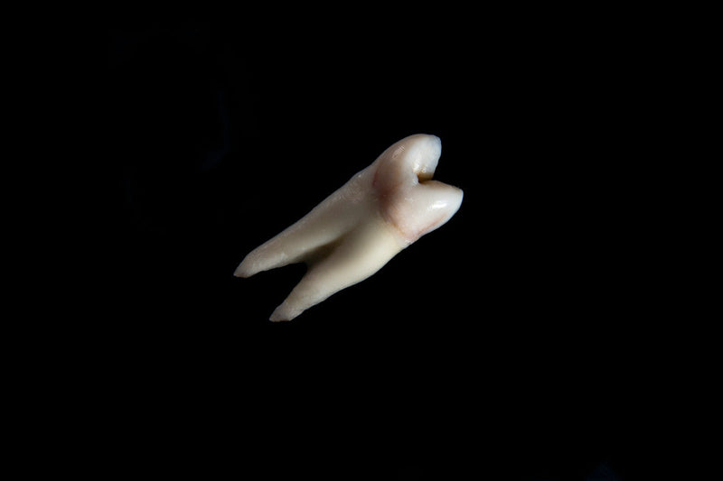 Can Remineralizing Toothpaste Heal Cavities?