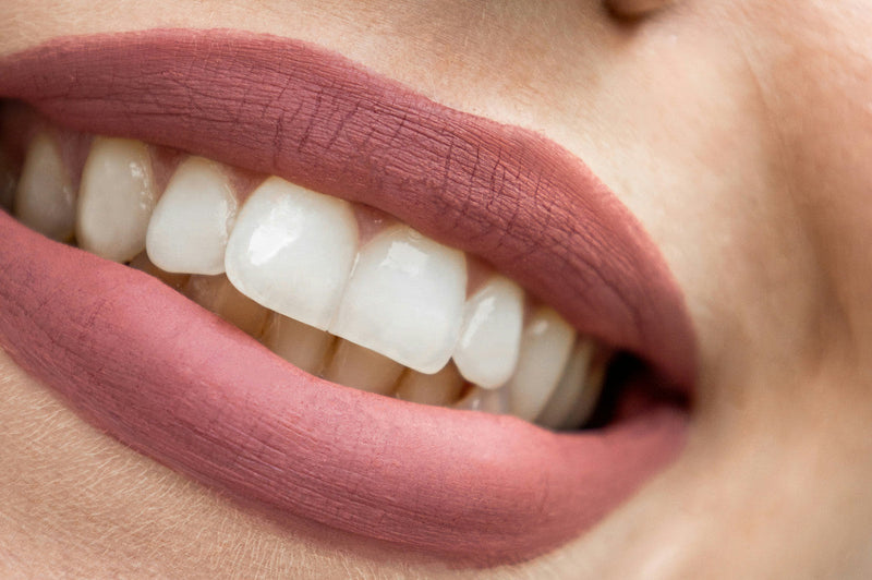 How to Treat Tooth Decay at the Gum Line
