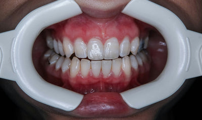 mouthwash vs toothpaste