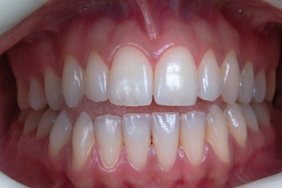 parodontax toothpaste vs sensodyne