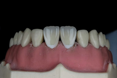 Peridex vs Listerine