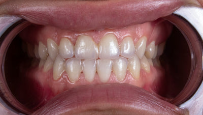 toothpaste vs tooth powder