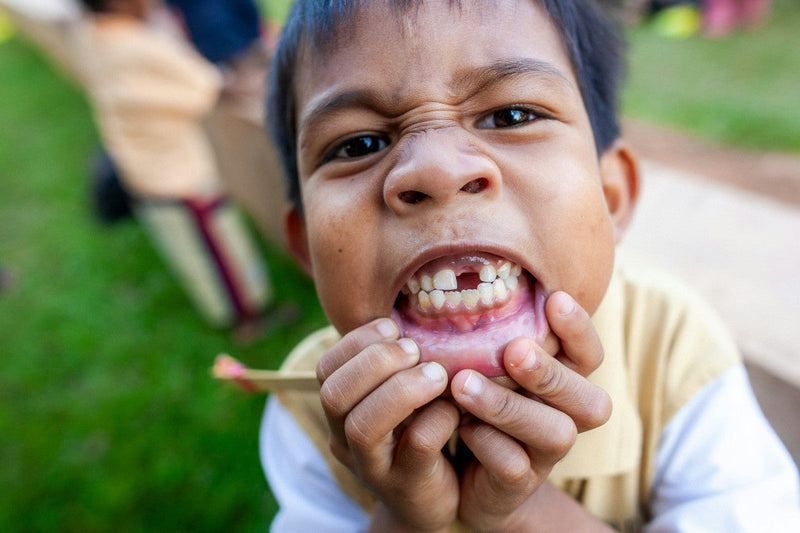 What Happens When Kids Don't Brush Their Teeth?