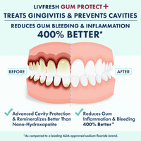 LIVFRESH Gum Protect+ Wintergreen Gel Toothpaste
