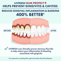 GP+ Wintergreen - 2Product Image - BeforeAfter_SingleMouth