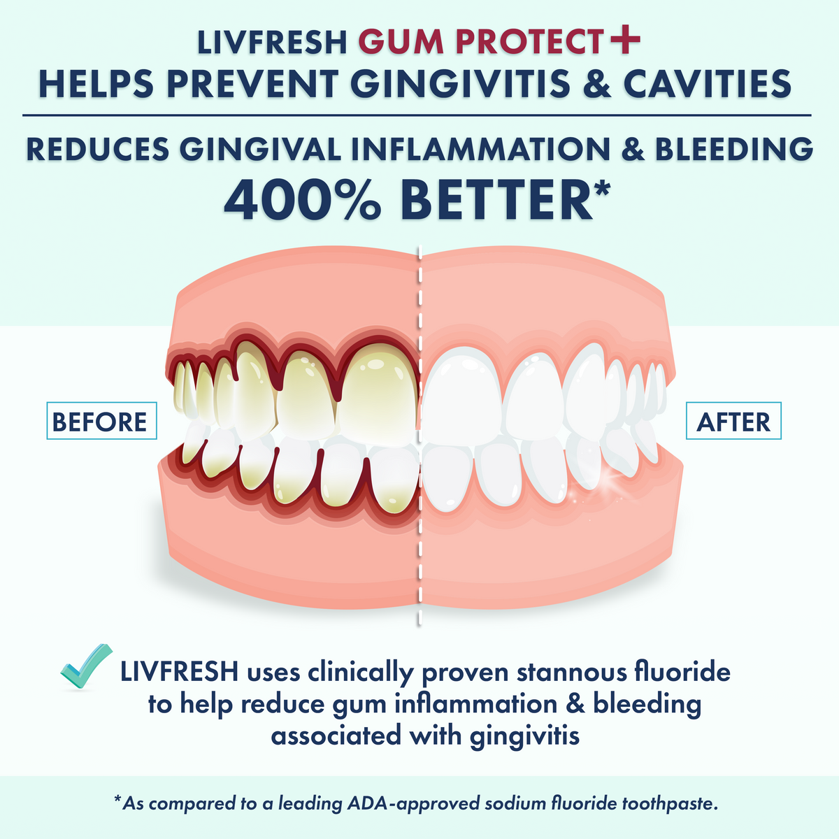 GP+ Wintergreen - 2Product Image - BeforeAfter_SingleMouth