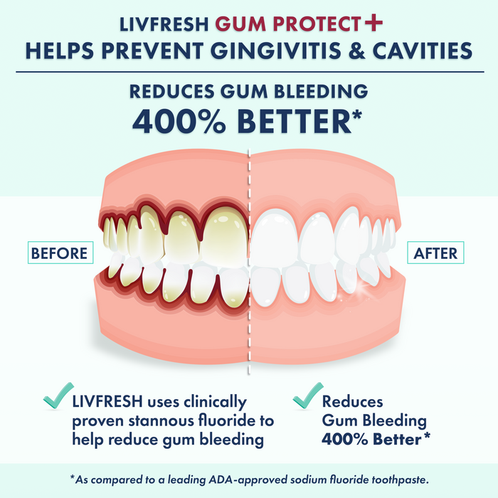 GP+ Wintergreen - 2Product Image - BeforeAfter_SingleMouth
