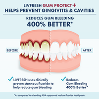GP+ Peppermint - 2Product Image - BeforeAfter_SingleMouth