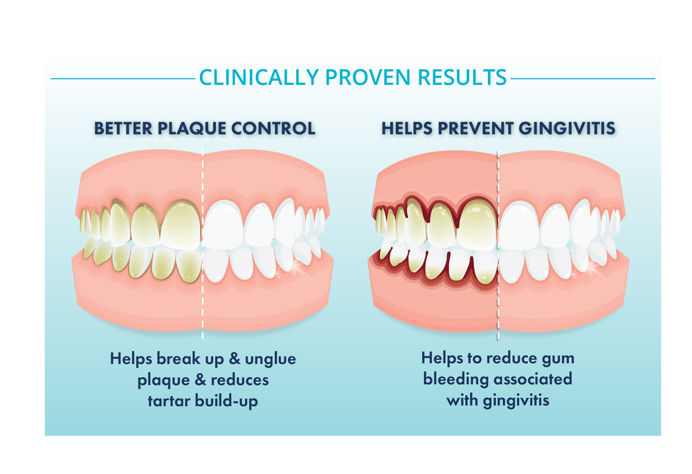RegUpdate Oct26 - Fluoride - fluoride_2 mouth_plaque gums
