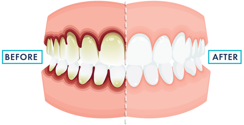 RegUpdate Oct26 - Home Pg - fluordie_mouth w BeforeAfter text boxes
