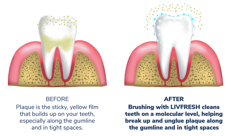 RegUpdate Oct26 - Home Pg - tooth before and after_2 tooth w text