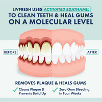 LivFresh Wintergreen Gel Toothpaste (Quiz)