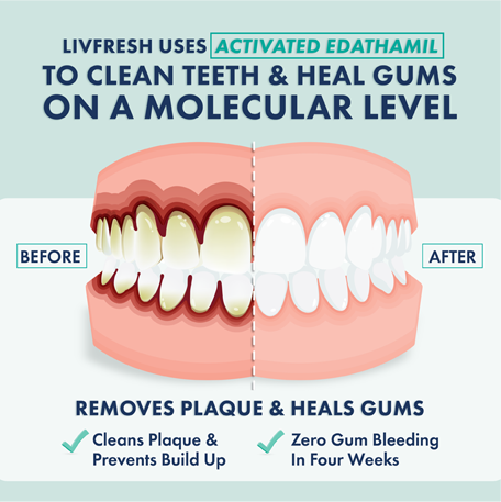 LivFresh Wintergreen Gel Toothpaste (Quiz)